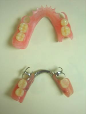 奥歯 の 入れ歯